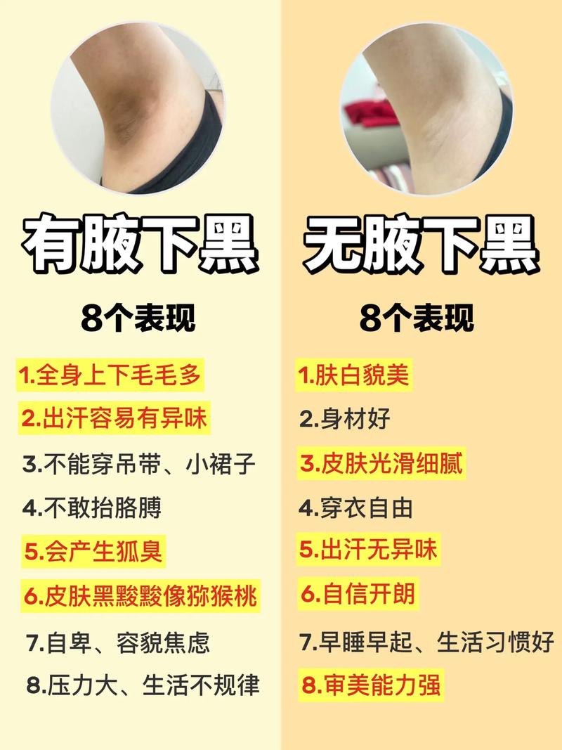 腋窝下皮肤变黑是怎么回事?游戏截图