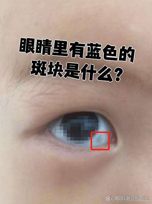 皮肤上有蓝色斑点图片游戏截图