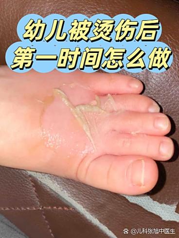 蚂蚁医生缩略图