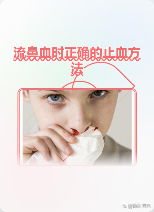 如何治疗流鼻血最快方法图标