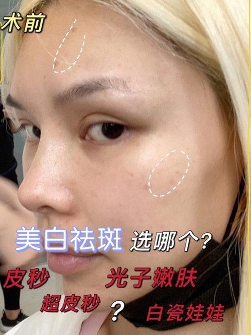 去除图片白色贴纸遮挡软件游戏截图