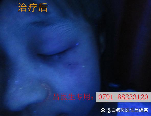 皮肤上出现蓝色的斑点游戏截图