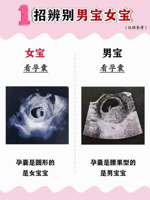 怎么辨别男孩女孩缩略图