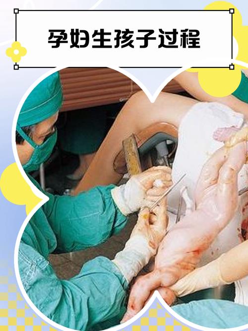 URJJ孕妇线生孩子缩略图