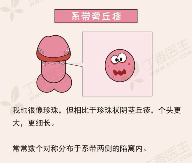 男性生殖有小疙瘩是怎么回事缩略图