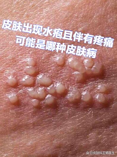 百度扫一扫识别皮肤病入口缩略图