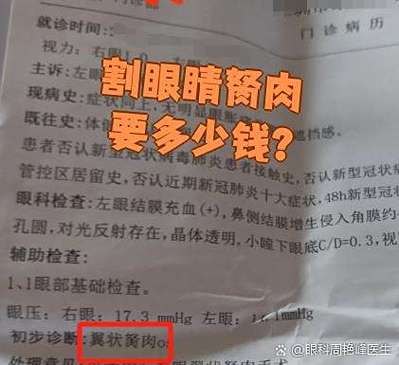 割眼睛胬肉要多少钱缩略图