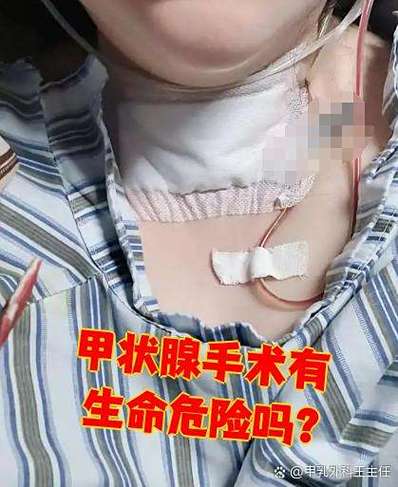 天津甲状腺肿瘤第一刀游戏截图
