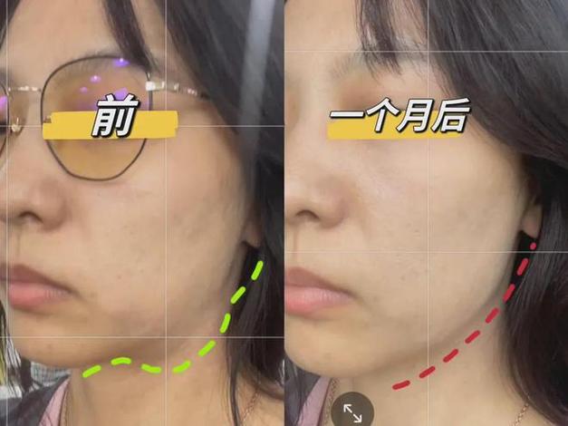 瘦脸怎么瘦最快缩略图