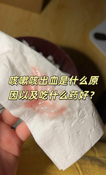 咳嗽喉咙痒鼻子有血有黄痰缩略图