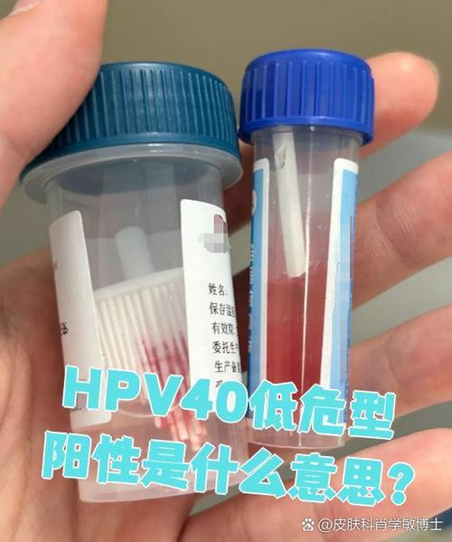 hpv低危40型阳性是什么意思游戏截图