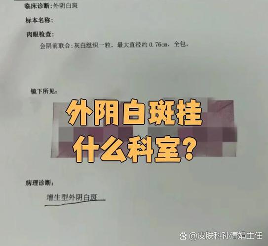 女性白斑去医院挂什么科游戏截图