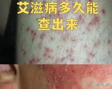 艾滋病多久能检查出来游戏截图