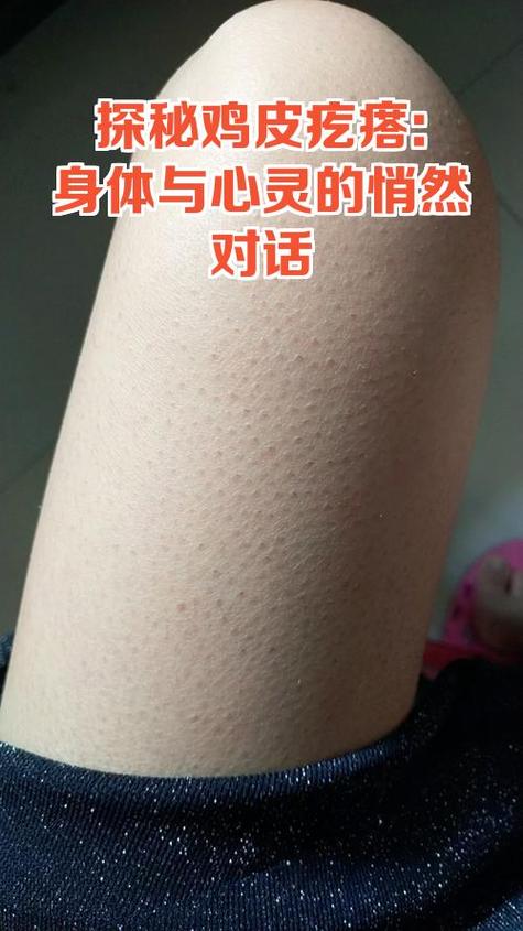 皮肉里有硬疙瘩缩略图