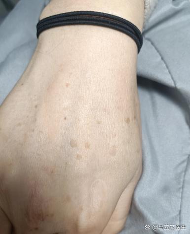 老化的特征有哪些缩略图