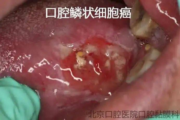 口腔溃疡病理检查怎么做游戏截图