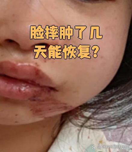 脸摔肿了挂什么科缩略图