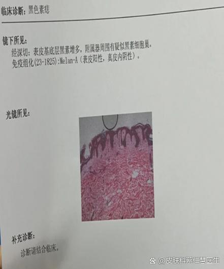 皮肤上有凸起的小疙瘩缩略图