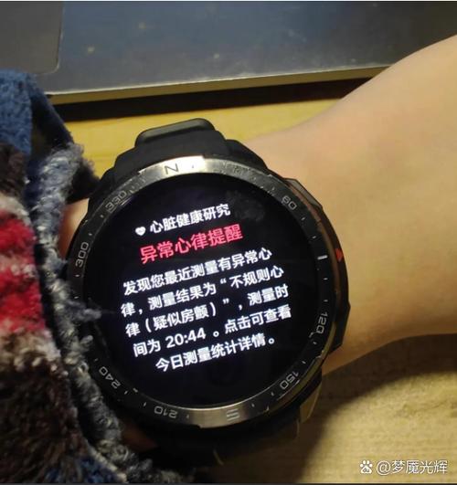 心率手表真的有用吗缩略图