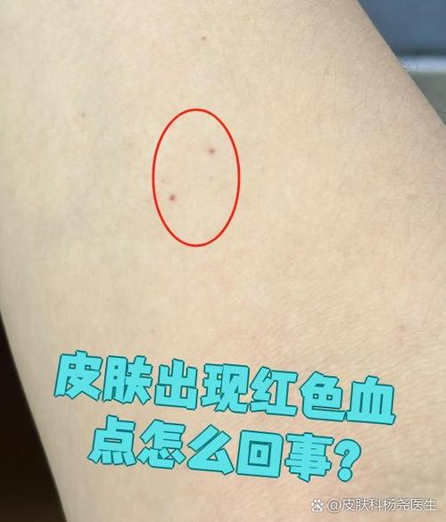 皮肤上出现红点缩略图