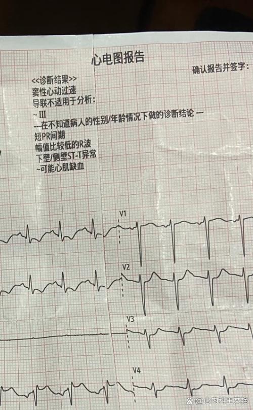 心率110-120有危险吗缩略图