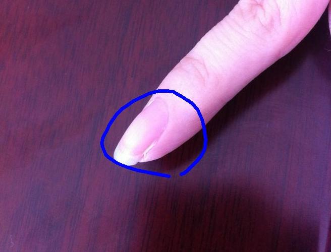 孩子指甲上有紫色条纹游戏截图