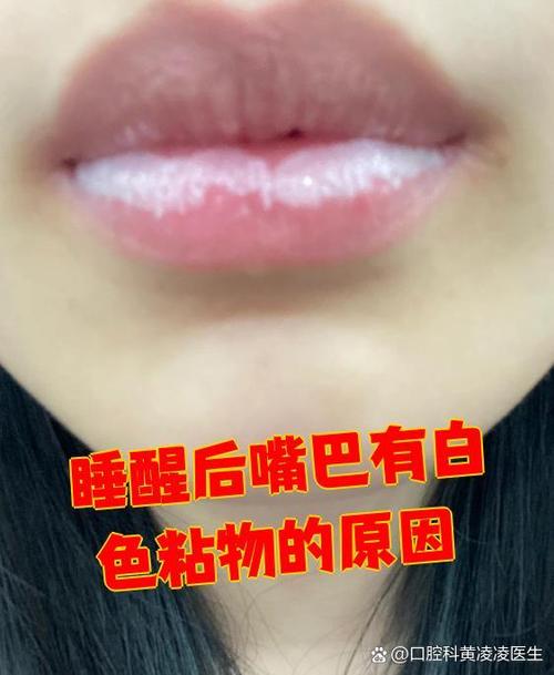 嘴巴老是黏黏糊糊的图标