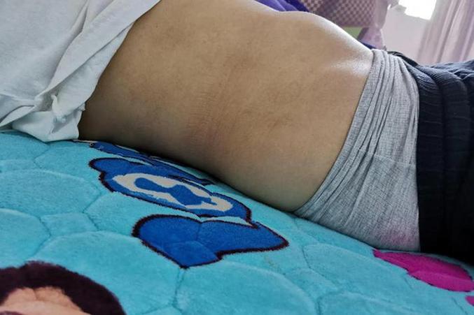 怀孕女孩肚脐是凹还是凸缩略图