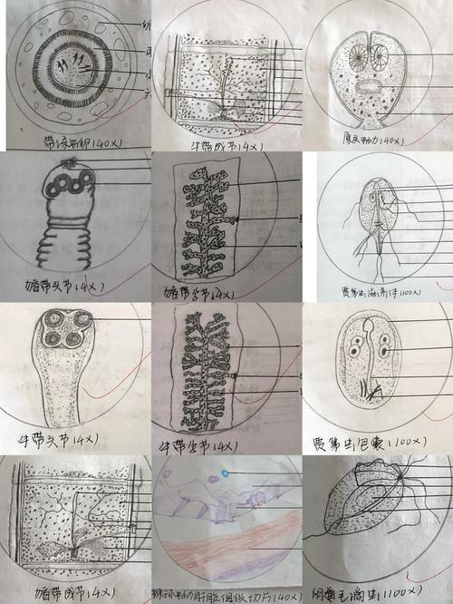 寄生虫寄生女生肚子视频缩略图