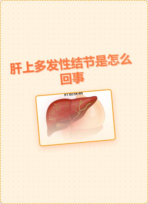 肝囊肿是什么病,需要治疗吗缩略图
