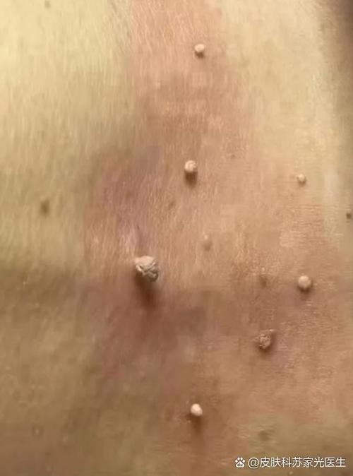 猪肉切开有红色肉疙瘩缩略图
