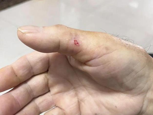 被仓鼠咬了有点肿游戏截图
