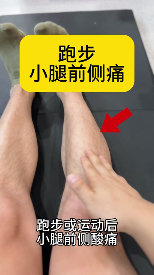 小腿肌肉酸痛游戏截图