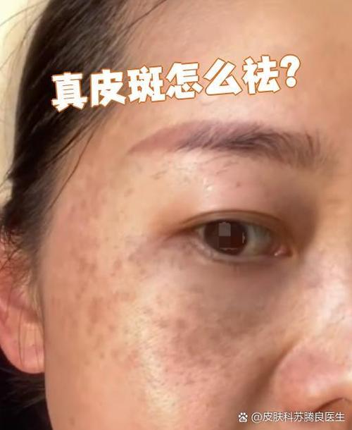 手机屏幕彩斑修复方法缩略图