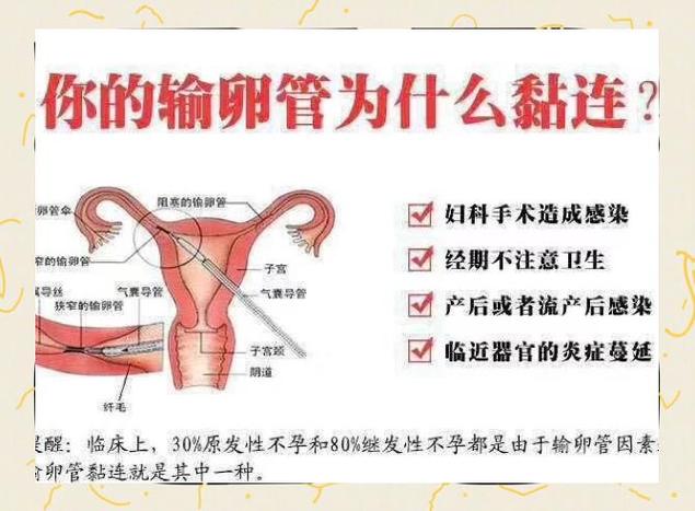 输卵管粘连做手术需要多少钱缩略图