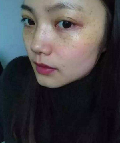 脸上有黑色的斑点游戏截图