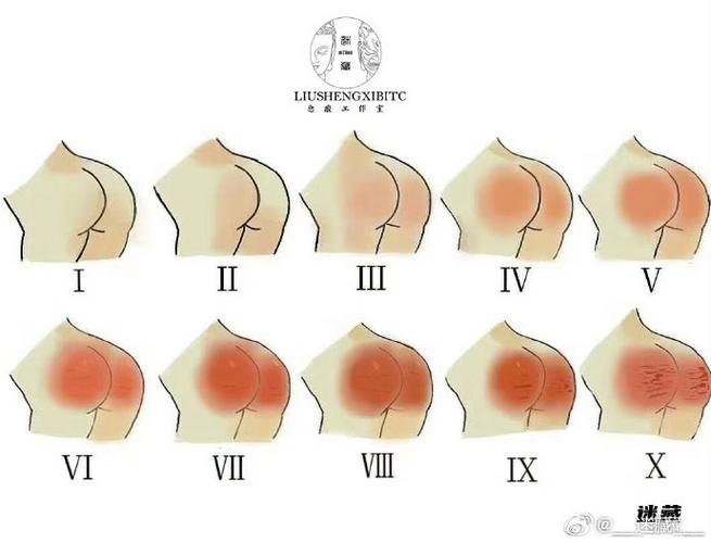 sp红肿症状颜色对照图缩略图