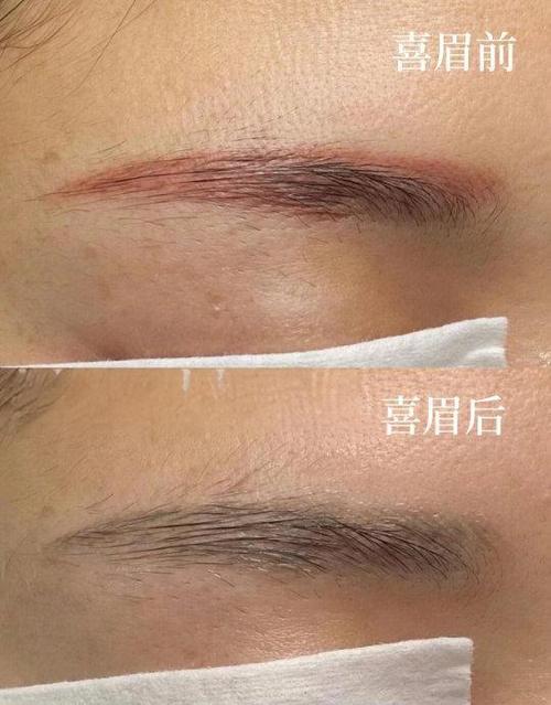纹眉后变蓝色好还是红色好缩略图