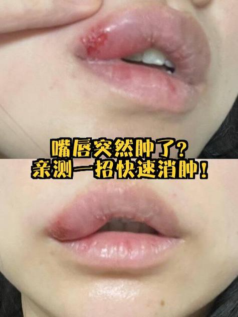 肿怎么消除最快方法游戏截图