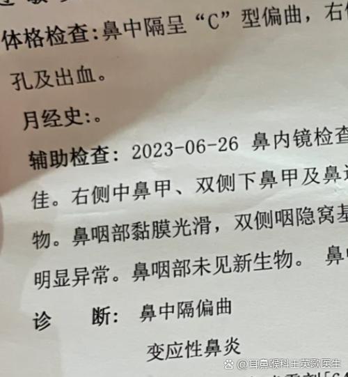 流鼻血可以做鼻镜吗缩略图