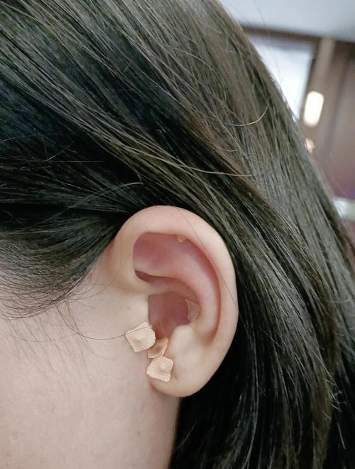 airpods4容易掉出耳朵怎么办缩略图