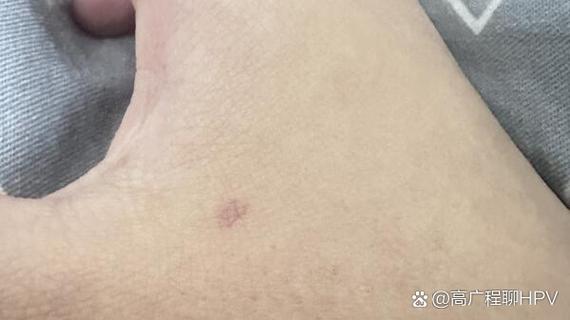 腹乳沟结节能喝酒吗游戏截图