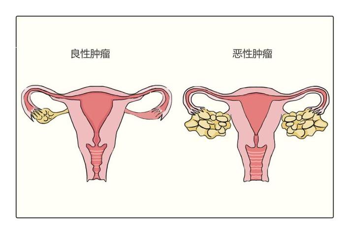 什么是肿瘤缩略图