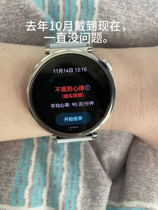 华为手表5隐藏功能缩略图