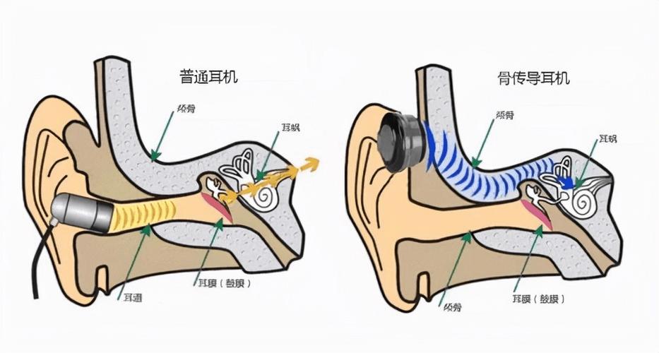 骨传导耳机漏音什么意思游戏截图