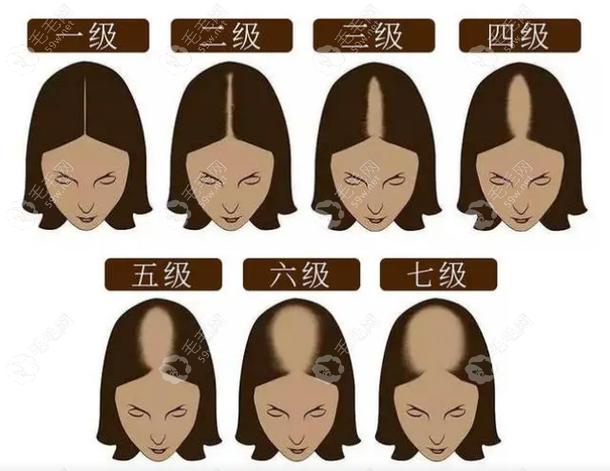 女生发851是什么意思缩略图