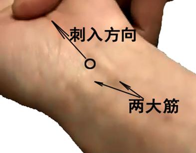 针灸大成教学视频缩略图