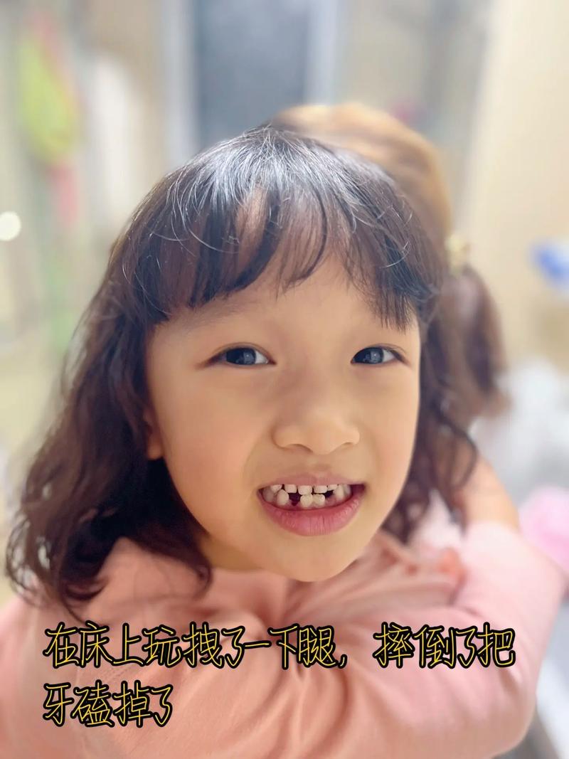 豁牙表情包缩略图