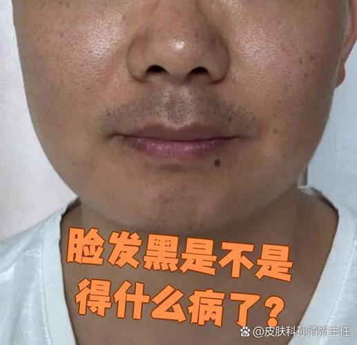 人脸越来越黑是什么原因缩略图