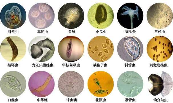 20种常见寄生虫图片缩略图